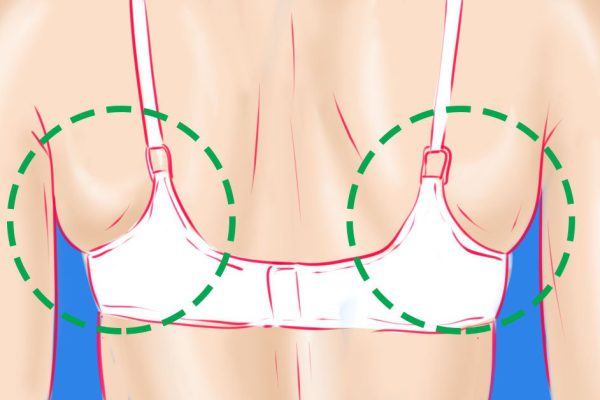 10 позорных ошибок в ношении нижнего белья: желание соблазнить, доведенное до абсурда!