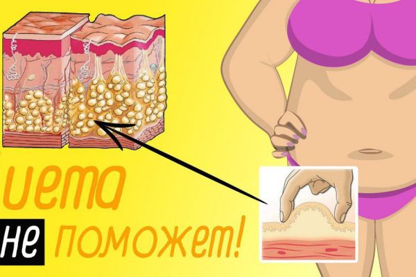 Минус 8 см сходу, за первые 14 дней! Разработано для женщин 50 с хвостиком…