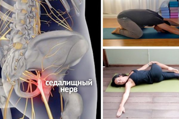 8 поз, которые являются лучшей профилактикой радикулита. Ты будешь поражен их эффективностью!