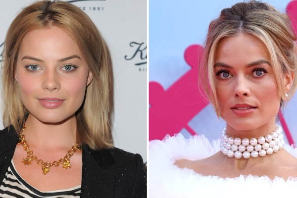 Пластический хирург рассказал, какие операции сделала Марго Робби, чтобы выглядеть как Барби