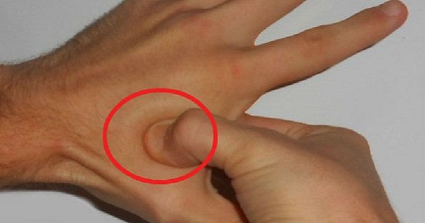 Сними головную боль и стресс за 30 секунд! С помощью акупрессуры это возможно.