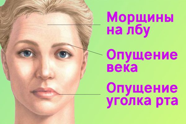 Чтобы возрастные изменения и асимметрия лица ушли, я каждый вечер…