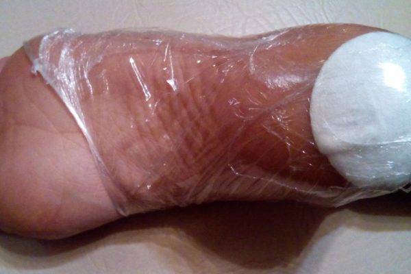 Сделав ЭТО, ты избавишься от трещин на пятках и мозолей всего за 10 дней!