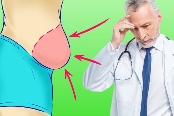 Понимающий врач: «Ко мне приходят вот с такими огромными животами! Сразу говорю, нужно отказаться всего от 1 вещества…»