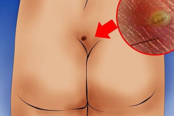 Это может быть причиной твоей боли в пояснице… То, что важно знать каждому.