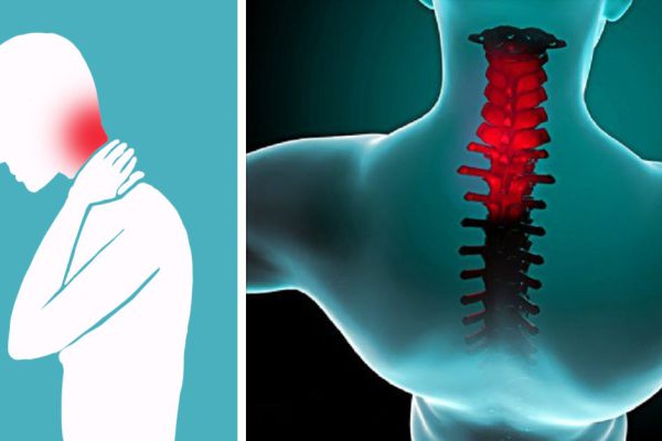 Эта методика избавит тебя от боли в шее и затылке всего за 90 секунд. Очень вовремя!