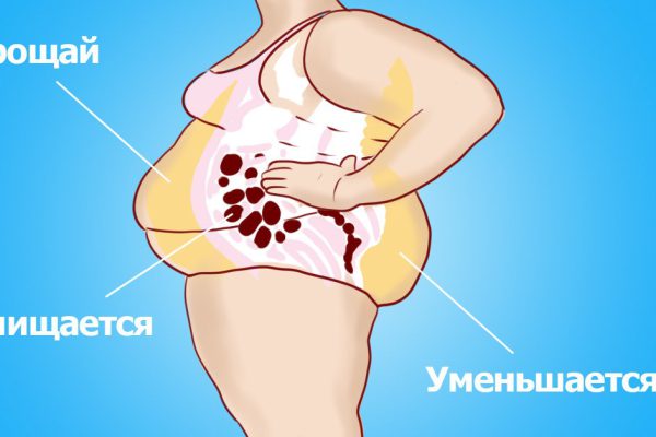 Этот суп способствует очищению организма! Вес уменьшается, а здоровье укрепляется.