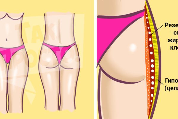 Не поддавайся на спекуляции косметологов… Избавься от проблемной «корочки» раз и навсегда!