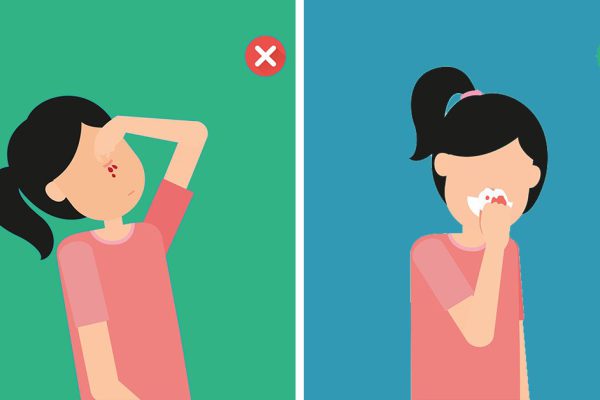 Оказывается, ты всегда останавливал носовое кровотечение неправильно! Губительная ошибка…