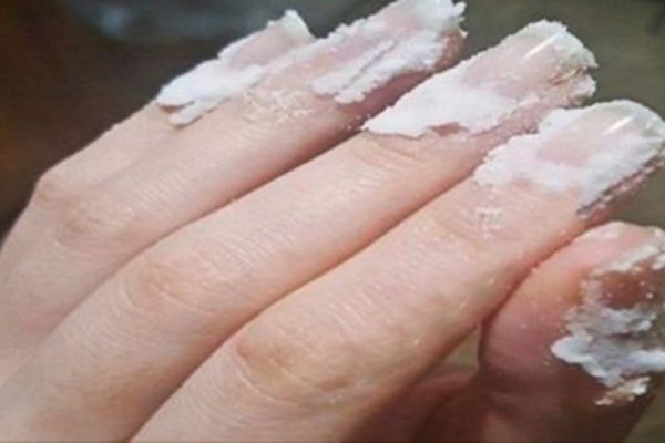 Слегка натри ногти содой и посмотри, что произойдет. Совершенно другая картина!