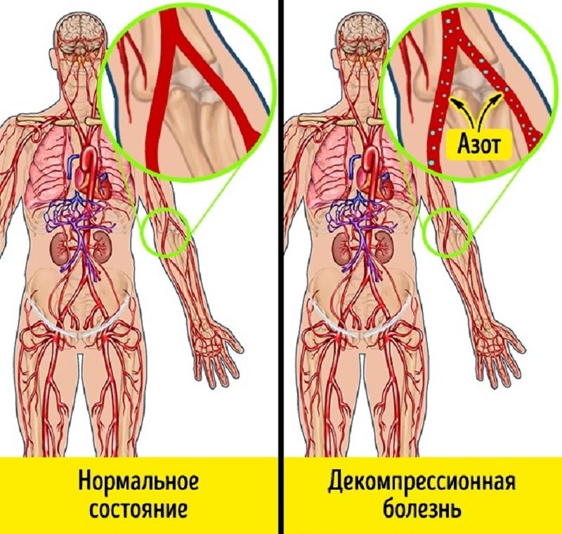 перепад давления