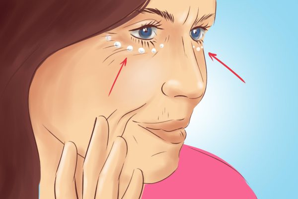 Как забыть о черных кругах под глазами