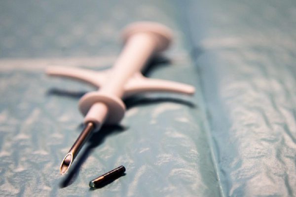 Зачем вживлять себе микрочип