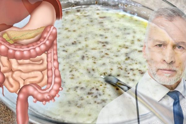 Очищение кишечника от всякой слизи, микробных отложений, накопленной мерзости! Одно вещество…