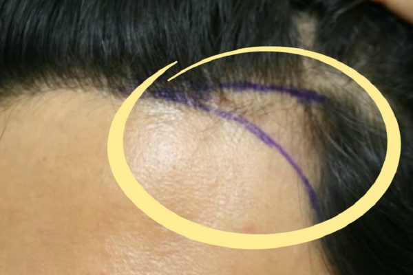 Волосы не держатся на голове? Есть простое решение, и не одно, а целых пять!