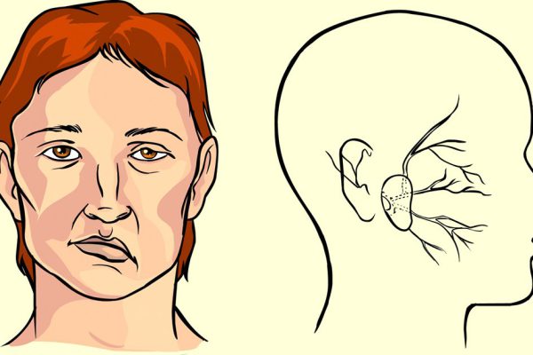 Нетрадиционный, но очень эффективный метод спасения от инсульта. Срочно бери иголку!