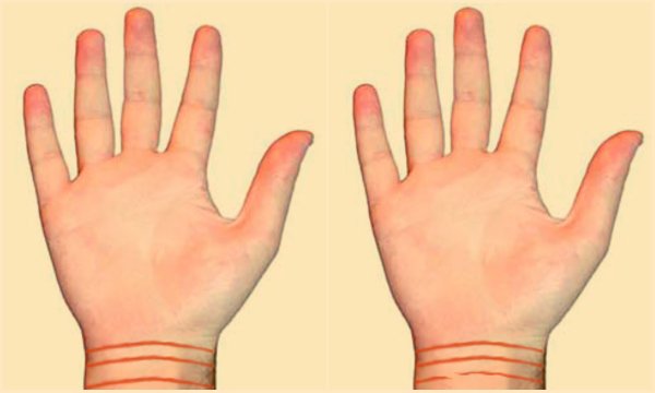 линии на запястье