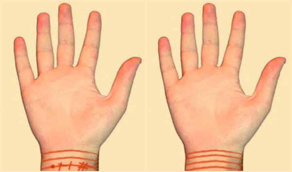 линии на запястье