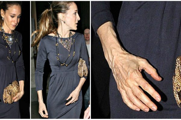 Основные признаки старения и как с ними бороться. У знаменитостей свой подход!