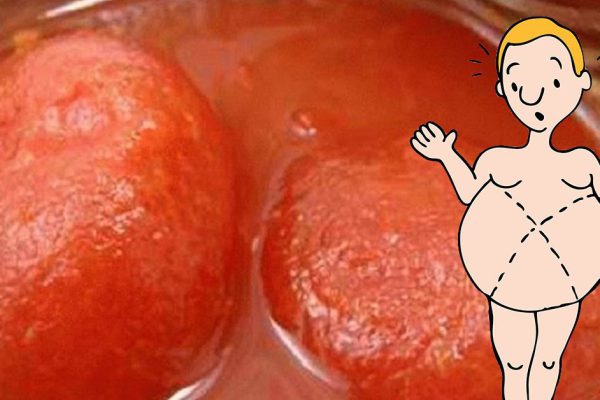 Их нельзя есть. Никогда. Нужно просто принять это как данность!