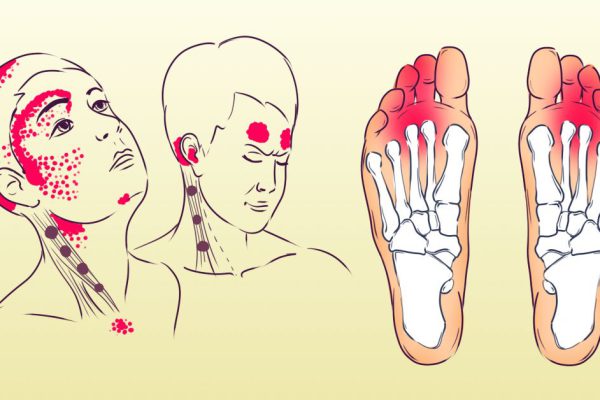 Постоянная усталость, ухудшение зрения и увеличение веса — всё это вызывает недостаток всего лишь одного витамина!