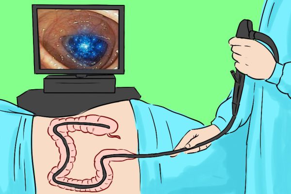 Если врач будет настаивать на колоноскопии, скажи ему вот что… Развенчиваем миф!