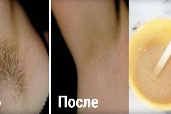 Удаление нежелательных волос в области подмышек всего за 2 минуты! Без раздражения.