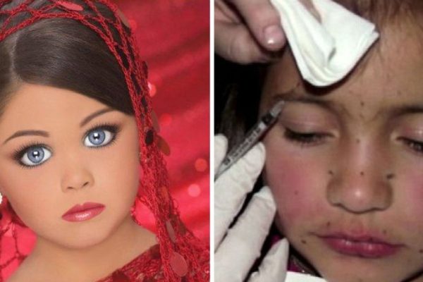 Инъекции ботокса в 7 лет… Это цветочки, по сравнению с тем, что делают родители ради детского конкурса красоты.