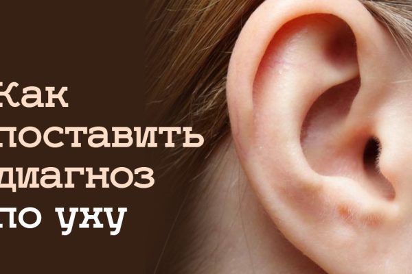 Внимательно посмотрев на уши, можно многое узнать о своем здоровье! Незаурядная диагностика.