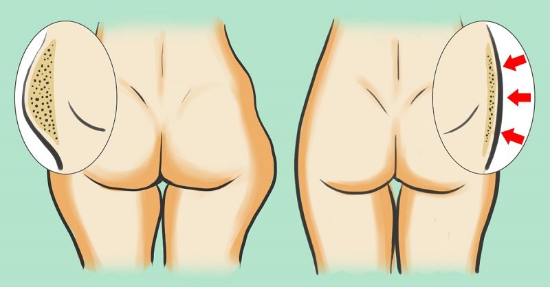 похудение без диет и тренировок