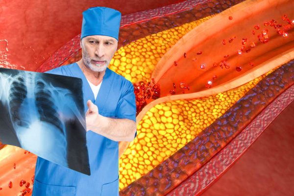 «Состав каждой группы крови предполагает специальную диету!» Похудеть стремительно можно, учитывая…