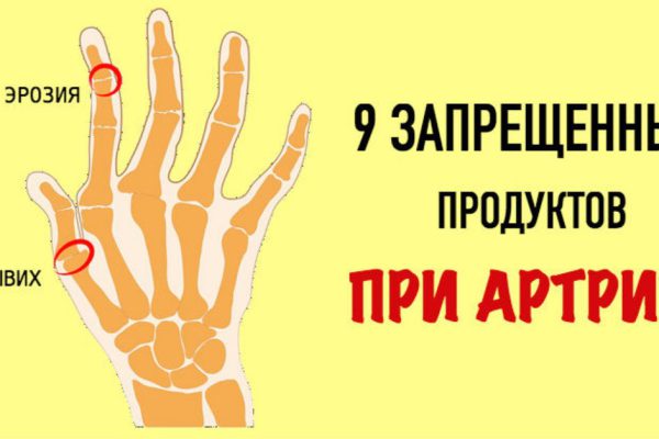 Эти 9 продуктов — убийцы суставов! Врачи настоятельно рекомендуют сменить…