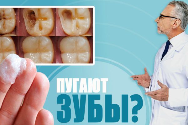 Жена стоматолога научила меня устранять зубной камень и отбеливать зубы за 4 минуты.