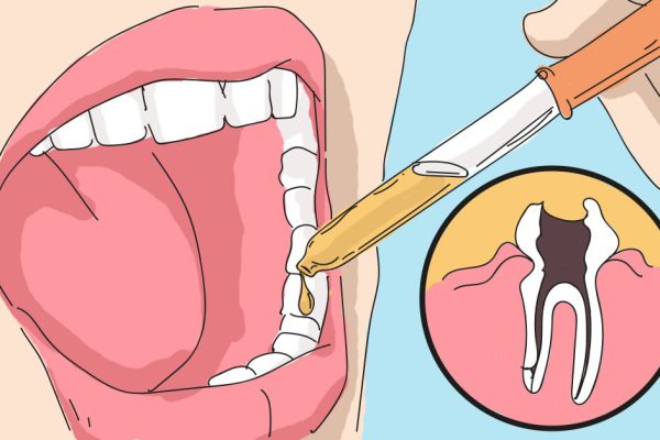 Испробовал всё, но помогло лишь это… Просто приложил к зубу, и боль ушла мгновенно!