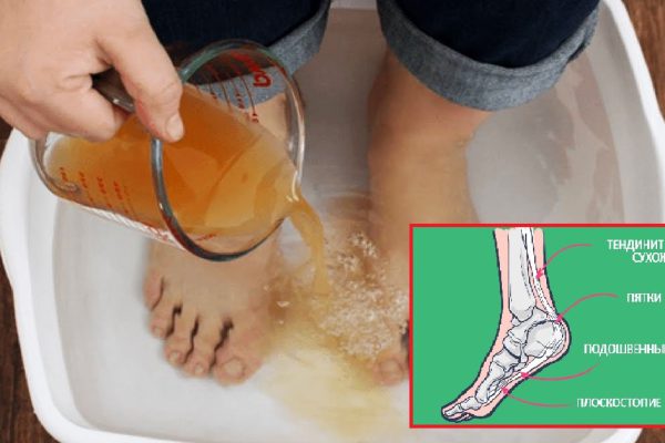 Смой с ног усталость и болезни! Освободи тело от токсинов, окунувшись в этот раствор на 20 минут.
