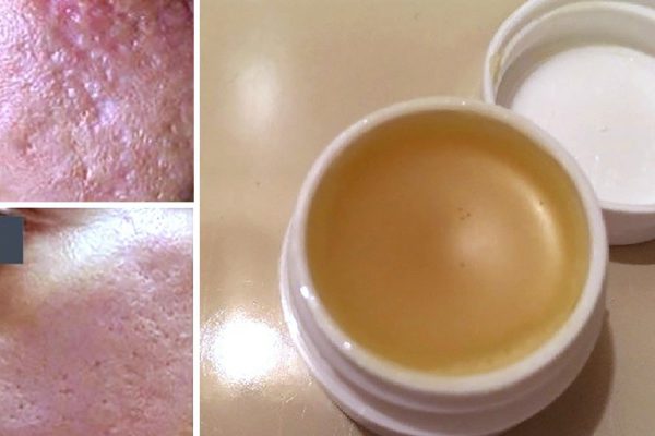 Домашний крем из какао-масла — ароматное средство для избавления от рубцов.