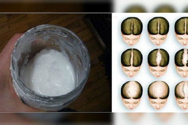 Вот как мне удалось отрастить длинные волосы: помог всего 1 действенный компонент!