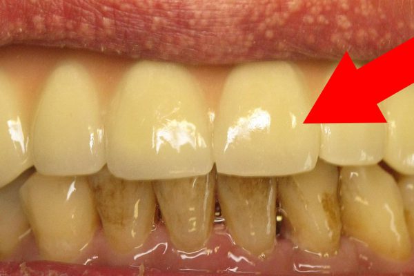 Дедушка за 72 года ни разу не был у стоматолога… Он просто 3 раза в неделю применяет ЭТО средство!