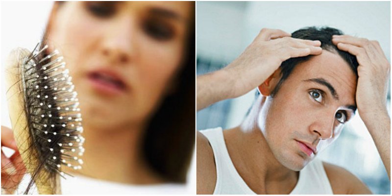vypadávanie vlasov u mužov i žien