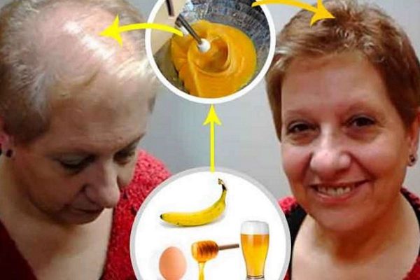 Рост волос усиливается на 272 %! Этот метод знают немногие! Вся суть в нескольких каплях…