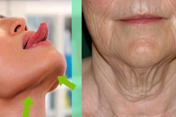 Вот как обычный творог помог избавиться от «вялой шеи»! Понадобилось всего 15 минут…