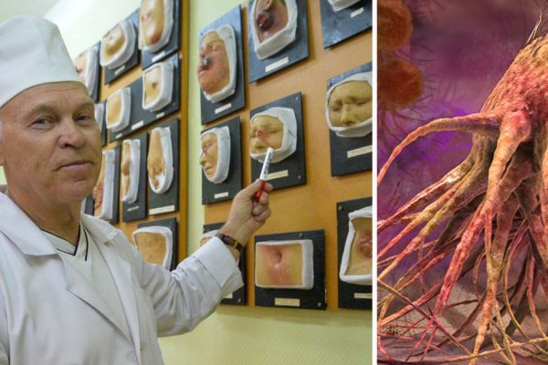 Решение проблемы всей жизни найдено: в 2017 году FDA признала новую технологию, помогающую уничтожить раковые клетки.