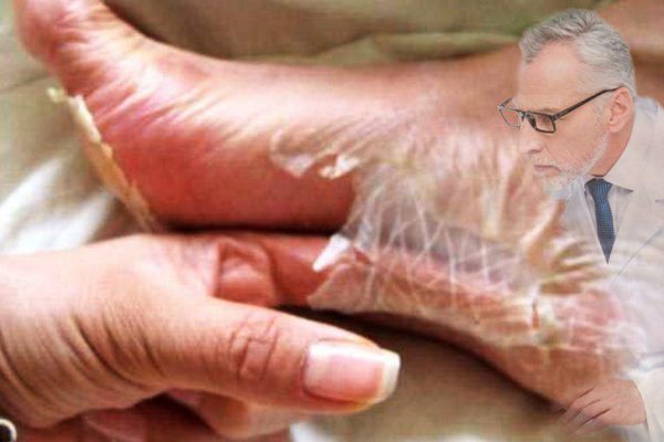 Чтобы пятки были как у школьницы! Нежные и мягкие, ни одной трещинки, просто ставлю ноги в…