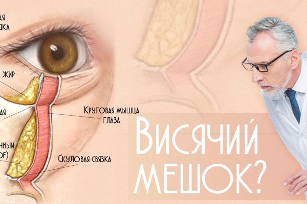 «Накопление жидкости в области под глазами останавливается, если капать на чистую сухую кожу…»