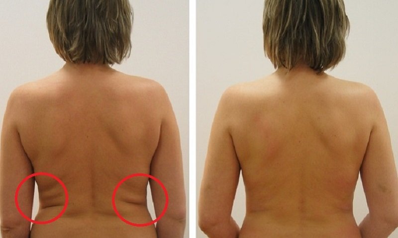 фрукты для похудения и выведения жира