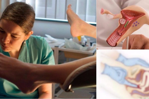 Регулярно хожу на гинекологический массаж… Избавилась от воспалительных процессов, инфекций и болезненных менструаций!