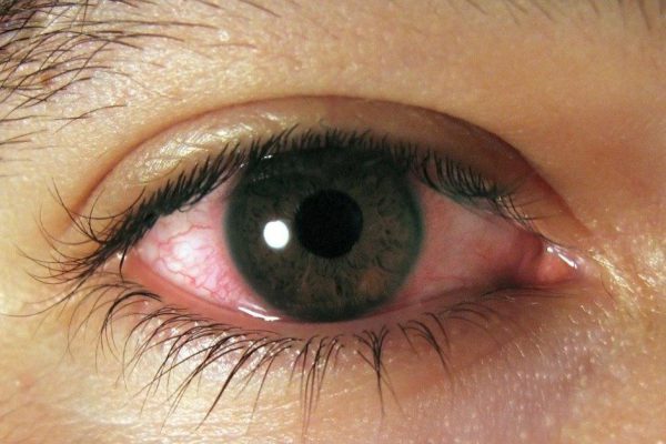 Обрати внимание! Эта ежедневная привычка провоцирует рак, ожирение, приводит к слепоте и…