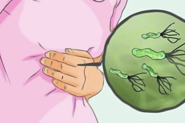 Вот почему у меня часто болит живот! Японские ученые выяснили, как победить опасную бактерию.