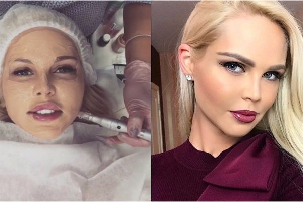 Мария Погребняк ввела под кожу специальную краску, которая заменит тоналку на целый год!