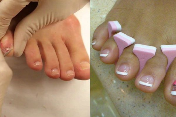 15 замечательных идей педикюра на лето. Теперь не буду стесняться гулять в сандалиях!